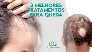 3 MELHORES tratamentos para queda capilar