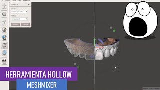 ¡¡Ahorrando Resina 3D!! - Convirtiendo un Modelo Dental 3D Sólido a un Modelo Hueco en Meshmixer.