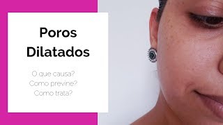 Poros Dilatados   Porque aparece, como evitar e como tratá los por Nara Borges