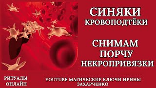 СИНЯКИ. КРОВОПОДТЁКИ. Разрыв мелких сосудов. Слабые сосудистые стенки. СНИМАМ ПОРЧУ и НЕКРОПРИВЯЗКИ.