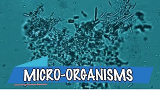 Micro-Organisms & Macro organisms-Grade 11