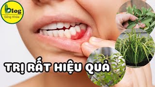 Tổng hợp những bài thuốc trị viêm chân răng