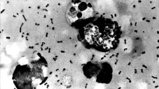 China 'seals off' town after man dies of bubonic plague