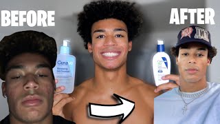 SKIN CARE ROUTINE | HOW I GOT RID OF CYSTIC ACNE