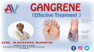 Effective Treatment for Gangrene  |  How To Cure Gangrene (गैंग्रीन) |  Dr. Ashish Airen