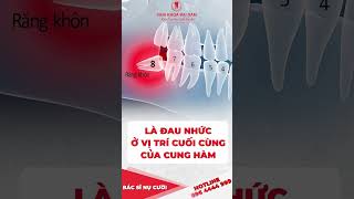 Nhiều bạn thắc mắc: Răng khôn là răng số mấy | Nha khoa Đại Nam #shorts