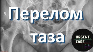 Перелом таза. Неотложная помощь