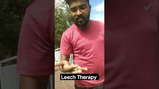 #munnar #therapy explained by Mukesh #tamilfacts #medicine #leech #Tamilshorts