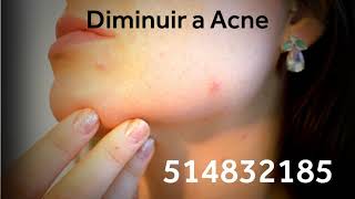 Números Grabovoi para Diminuir a Acne - 514832185