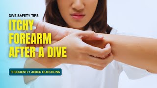 FAQ Itchy skin after diving