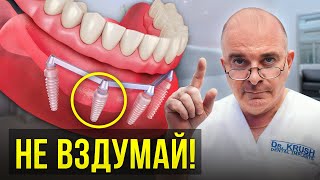 НИКОГДА не устанавливай ТАКИЕ протезы! ГЛАВНАЯ ошибка большинства..