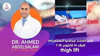 شد الفخذ جراحيا انستجرام لايف  ١٥ اكتوبر ٢٠١٨ thigh lift