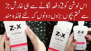 Z-X Lotion For Allergy | Kharish Door Karne Ka Tarika | Kharish Se Nijat | Bachon Baron Dono Ke Lie