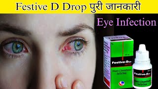 Festive D Eye/Ear Drop | Ofloxacin And Betamethasone Eye/Ear Drops | Dose | Side effects