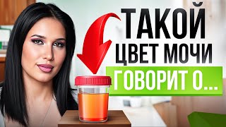 ВОТ, что вам расскажет о здоровье ЦВЕТ и ЗАПАХ вашей мочи!