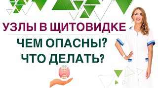 💊❤️ ЩИТОВИДНАЯ ЖЕЛЕЗА. УЗЛЫ И КИСТЫ: ЧЕМ ОПАСНЫ❓ ЧТО ДЕЛАТЬ❓ Врач эндокринолог Ольга Павлова