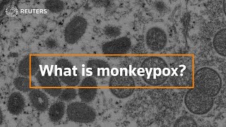 What is monkeypox and how dangerous is it?