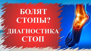 ✔Как определить состояние здоровья по стопам человека? / Методы лечения ног💥 #ноги #лфк