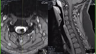 neuroradiology masterclass P2