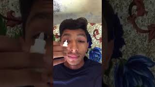 Eyes infection in Pakistan #shorts #viralvideo #eyesinfection