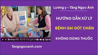 Cách điều trị bệnh gai gót chân | Lương y Tăng Ngọc Ánh - 0944.319.568