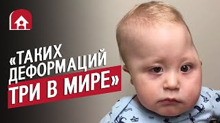 У моего сына деформация черепа: Таня | Быть мамой