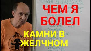 ЧЕМ Я БОЛЕЛ. КАМНИ В ЖЕЛЧНОМ