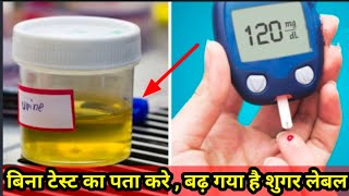 पेशाब में शुगर के लक्षण | High blood sugar level in urine | high blood sugar.