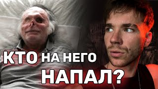 Потерял ЛИЦО после НАПАДЕНИЯ.😱 Жуткие истории.