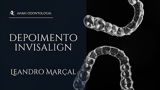 DEPOIMENTO INVISALIGN - Leandro Marçal