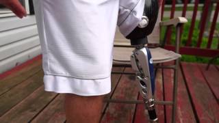 AmputeeOT: How An Above Knee (AK) Prosthetic Leg Works