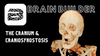 The Cranium and Craniosynostosis | 3D Anatomy