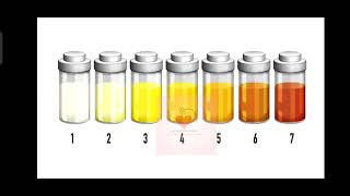 Urine (urine colour chart) #laboratory #urinetest #fundamentalanalysis #diagnosis #svmedicourse