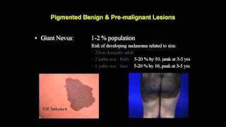 Skin Cancer Management | Dr. Rex Moulton-Barrett