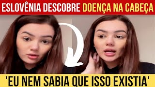 🔴[URGENTE]   EX BBB ESLOVÊNIA DESCOBRE DOENÇA NA CABEÇA