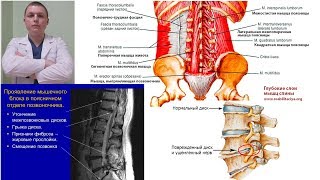 Мышцы Спины укреплять | НЕВЕРНО | С чего начать | Back Pain Еxercises