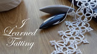 Tatting Lace: From Wish to Reality on International Tatting Day