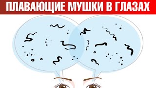 Как избавиться от мушек в глазах? Мушки перед глазами: причины🧐