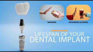 Dental implant treatment (DR.Sudhakara Reddy)