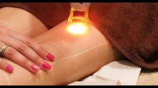 Αποτρίχωση Laser | Dionysiou Medi Spa