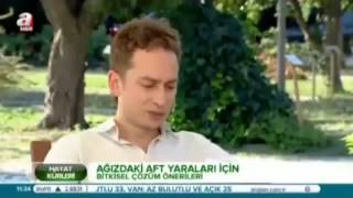 Prof İbrahim Adnan Saracoglu Gulben (11/16) Ağız yarası, AFT, B12, yoğurt otu, limon suyu