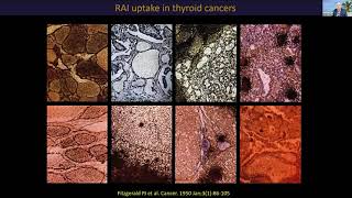 MTOS 2021 Nuclear Workshop: Molecular Basis of RAI Theranostics