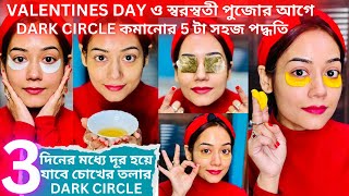 Dark Circle কমানোর 5 টা সহজ পদ্ধতি Valentines Day ও সরস্বতী পুজোর আগে| #skincare