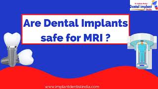 Are Dental Implants Safe for MRI?| Best Dental Implants in Bengaluru| Dental Implant Studio