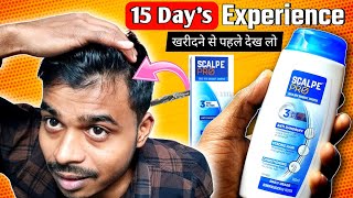 Best Dandruff Shampoo for Men - Scalpe Pro Anti Dandruff Sampu Review 😇 15 Day's Experience #2024