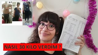 KORTİZON KULLANIRKEN NASIL 30 KİLO VERDİM | Motivasyon | Öncesi Sonrası Fotoğrafları