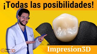 💡 ¿Qué se puede hacer con una impresora 3D en odontología? 😎