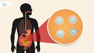 Enfermedad Inflamatoria Intestinal - Conociendo el tratamiento - Respuesta inmune