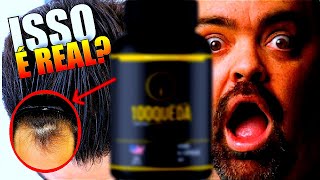 100QUEDA é bom? 100 QUEDA Funciona Mesmo? [ASSISTA] Calvície