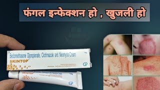 fungal infection cream | skintop cream | दाद की क्रीम | Best Fungal Infection Creams | Dermatologist